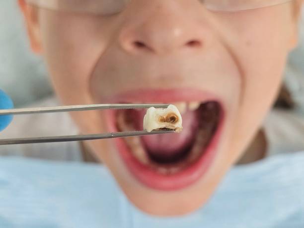 Best Cosmetic Emergency Dentistry in Rinna, VA
