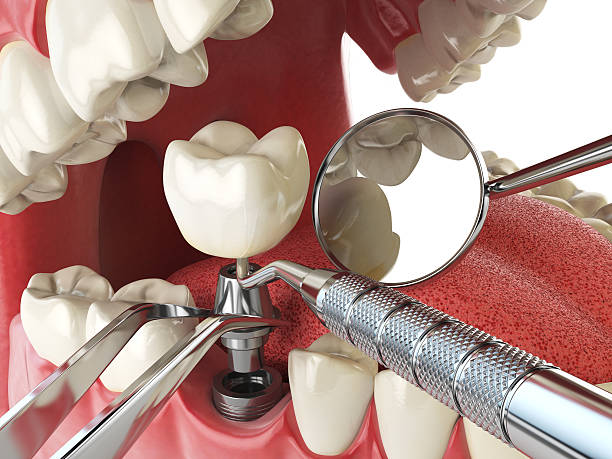 Best Same-Day Emergency Dental Services in Rinna, VA